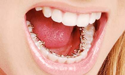 Ορθοδοντική 2